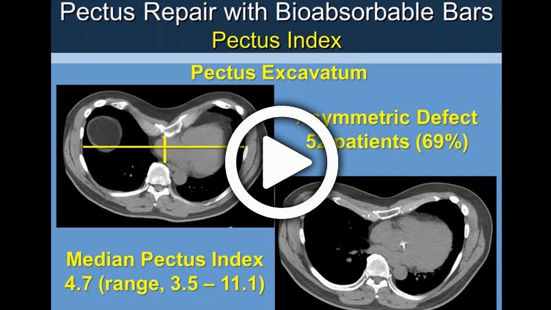 Resorbable Technologies In Thoracic Reconstruction With Daniel Miller 