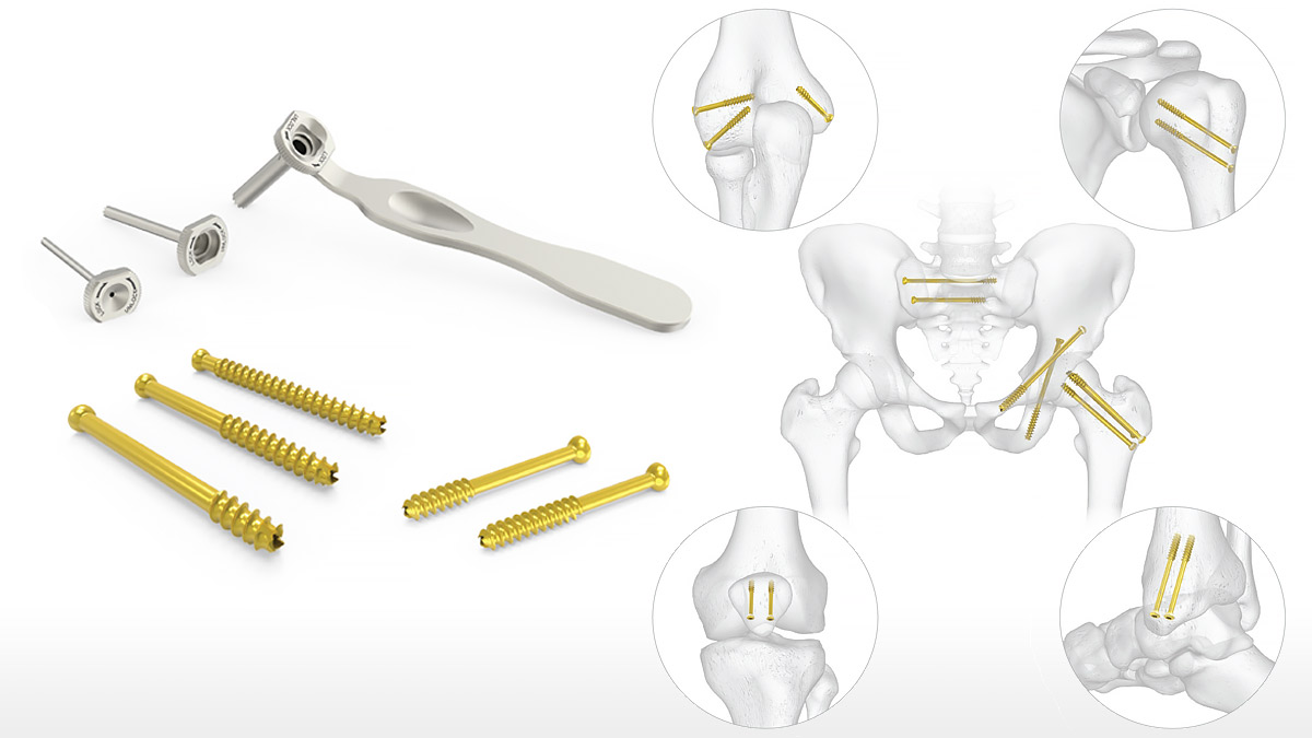 General purpose compression bone screw - Z-Medical - cannulated